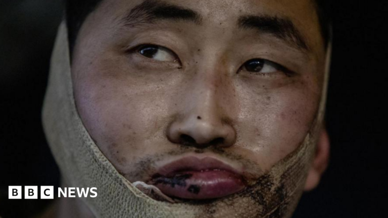 A photo posted by Ukrainian President Volodymyr Zelensky purportedly showing one of the two captured North Korean soldiers