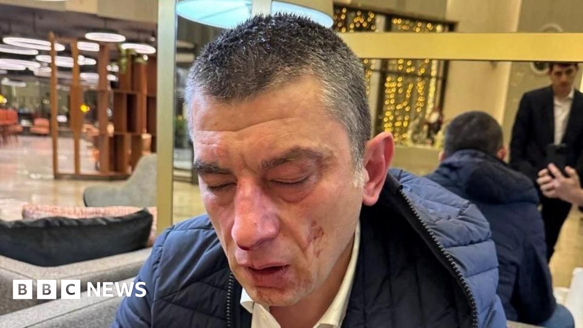 A Georgian opposition leader sits down after he is attacked at a hotel, clearly showing his injuries