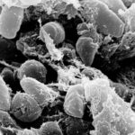 California population catch a outbreak, possibility from infected flea at Tase Tahe, Office


