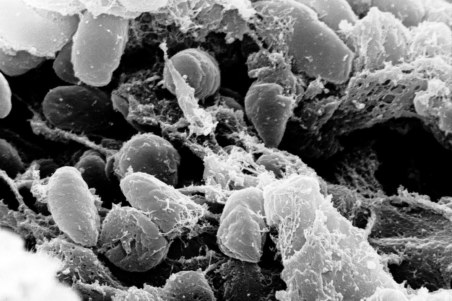 California population catch a outbreak, possibility from infected flea at Tase Tahe, Office